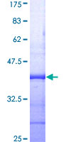 ZNF346 Protein - 12.5% SDS-PAGE Stained with Coomassie Blue.