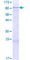 ZNF354A Protein - 12.5% SDS-PAGE of human ZNF354A stained with Coomassie Blue