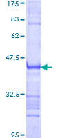 ZNF354A Protein - 12.5% SDS-PAGE Stained with Coomassie Blue.