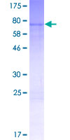 ZNF354C Protein - 12.5% SDS-PAGE of human ZNF354C stained with Coomassie Blue