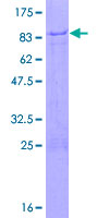ZNF358 / ZFEND1 Protein - 12.5% SDS-PAGE of human ZNF358 stained with Coomassie Blue
