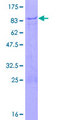 ZNF358 / ZFEND1 Protein - 12.5% SDS-PAGE of human ZNF358 stained with Coomassie Blue