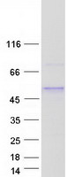ZNF362 Protein - Purified recombinant protein ZNF362 was analyzed by SDS-PAGE gel and Coomassie Blue Staining