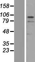 ZNF366 Protein - Western validation with an anti-DDK antibody * L: Control HEK293 lysate R: Over-expression lysate