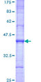ZNF37A Protein - 12.5% SDS-PAGE Stained with Coomassie Blue.