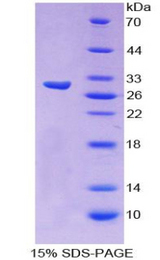 ZNF384 Protein - Recombinant  Nuclear Matrix Protein 4 By SDS-PAGE