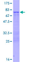 ZNF385A / ZNF385 Protein - 12.5% SDS-PAGE of human ZNF385 stained with Coomassie Blue