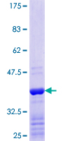 ZNF385A / ZNF385 Protein - 12.5% SDS-PAGE Stained with Coomassie Blue.