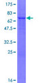 ZNF396 Protein - 12.5% SDS-PAGE of human ZNF396 stained with Coomassie Blue