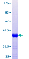 ZNF397 Protein - 12.5% SDS-PAGE Stained with Coomassie Blue.
