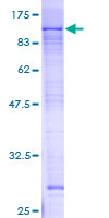 ZNF398 Protein - 12.5% SDS-PAGE of human ZNF398 stained with Coomassie Blue