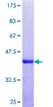 ZNF398 Protein - 12.5% SDS-PAGE Stained with Coomassie Blue.