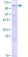 ZNF41 Protein - 12.5% SDS-PAGE of human ZNF41 stained with Coomassie Blue