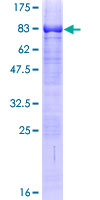 ZNF410 Protein - 12.5% SDS-PAGE of human ZNF410 stained with Coomassie Blue