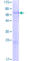 ZNF414 Protein - 12.5% SDS-PAGE of human ZNF414 stained with Coomassie Blue