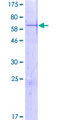 ZNF414 Protein - 12.5% SDS-PAGE of human ZNF414 stained with Coomassie Blue