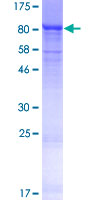 ZNF416 Protein - 12.5% SDS-PAGE of human ZNF416 stained with Coomassie Blue