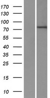 ZNF420 Protein - Western validation with an anti-DDK antibody * L: Control HEK293 lysate R: Over-expression lysate