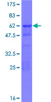 ZNF428 Protein - 12.5% SDS-PAGE of human C19orf37 stained with Coomassie Blue