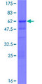 ZNF428 Protein - 12.5% SDS-PAGE of human C19orf37 stained with Coomassie Blue