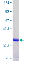 ZNF435 / ZSCAN16 Protein - 12.5% SDS-PAGE Stained with Coomassie Blue.