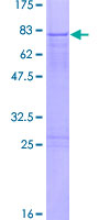 ZNF436 Protein - 12.5% SDS-PAGE of human ZNF436 stained with Coomassie Blue