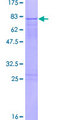 ZNF436 Protein - 12.5% SDS-PAGE of human ZNF436 stained with Coomassie Blue