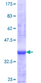 ZNF44 / GIOT-2 Protein - 12.5% SDS-PAGE Stained with Coomassie Blue.