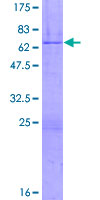 ZNF444 Protein - 12.5% SDS-PAGE of human ZNF444 stained with Coomassie Blue