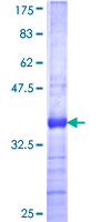ZNF446 Protein - 12.5% SDS-PAGE Stained with Coomassie Blue.