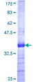 ZNF446 Protein - 12.5% SDS-PAGE Stained with Coomassie Blue.
