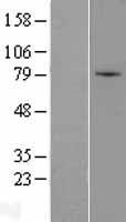 ZNF45 Protein - Western validation with an anti-DDK antibody * L: Control HEK293 lysate R: Over-expression lysate