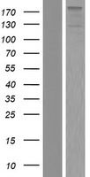 ZNF451 Protein - Western validation with an anti-DDK antibody * L: Control HEK293 lysate R: Over-expression lysate
