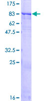 ZNF461 Protein - 12.5% SDS-PAGE of human ZNF461 stained with Coomassie Blue