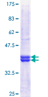ZNF461 Protein - 12.5% SDS-PAGE Stained with Coomassie Blue.