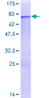 ZNF468 Protein - 12.5% SDS-PAGE of human ZNF468 stained with Coomassie Blue