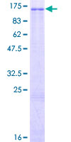 ZNF473 Protein - 12.5% SDS-PAGE of human ZNF473 stained with Coomassie Blue