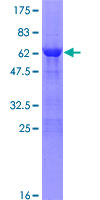 ZNF483 Protein - 12.5% SDS-PAGE of human ZNF483 stained with Coomassie Blue