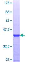 ZNF483 Protein - 12.5% SDS-PAGE Stained with Coomassie Blue.