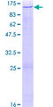 ZNF484 Protein - 12.5% SDS-PAGE of human ZNF484 stained with Coomassie Blue
