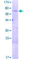 ZNF485 Protein - 12.5% SDS-PAGE of human ZNF485 stained with Coomassie Blue
