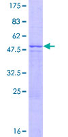 ZNF486 Protein - 12.5% SDS-PAGE of human ZNF486 stained with Coomassie Blue