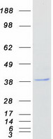 ZNF488 Protein - Purified recombinant protein ZNF488 was analyzed by SDS-PAGE gel and Coomassie Blue Staining
