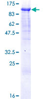 ZNF496 / NZIP1 Protein - 12.5% SDS-PAGE of human ZNF496 stained with Coomassie Blue