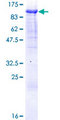 ZNF496 / NZIP1 Protein - 12.5% SDS-PAGE of human ZNF496 stained with Coomassie Blue