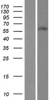 ZNF497 Protein - Western validation with an anti-DDK antibody * L: Control HEK293 lysate R: Over-expression lysate