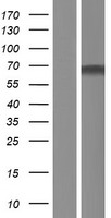 ZNF498 Protein - Western validation with an anti-DDK antibody * L: Control HEK293 lysate R: Over-expression lysate