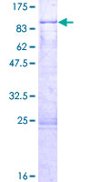 ZNF498 Protein - 12.5% SDS-PAGE of human ZNF498 stained with Coomassie Blue
