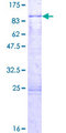 ZNF498 Protein - 12.5% SDS-PAGE of human ZNF498 stained with Coomassie Blue