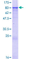 ZNF502 Protein - 12.5% SDS-PAGE of human ZNF502 stained with Coomassie Blue